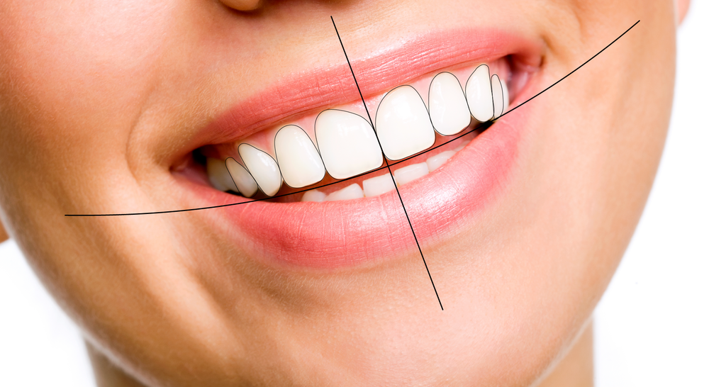 Best-smile-designing-treatment