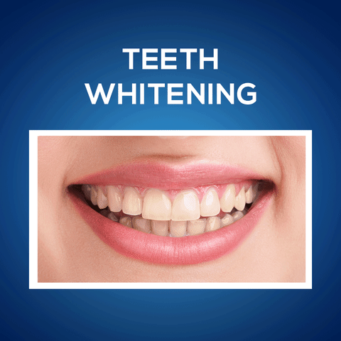 Teeth-whitening-treatment