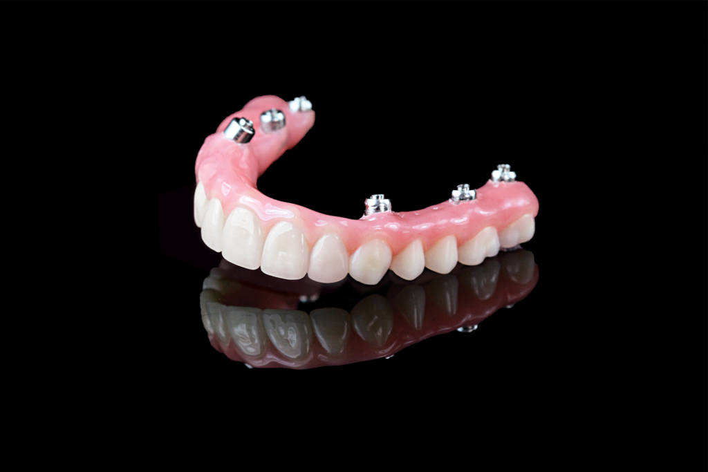 hybrid-dentures