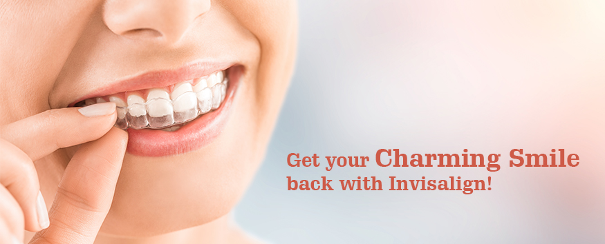 Invisalign Braces