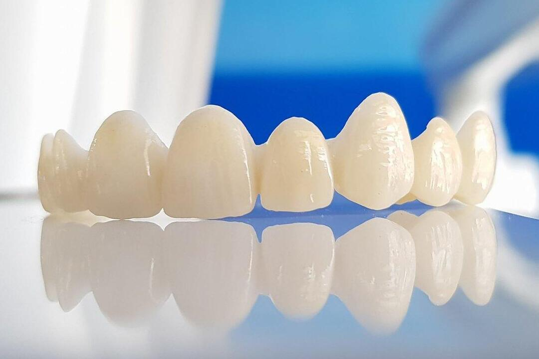 Zirconia Crowns