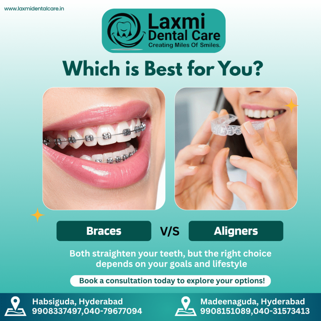 Best dental braces treatment in Hyderabad