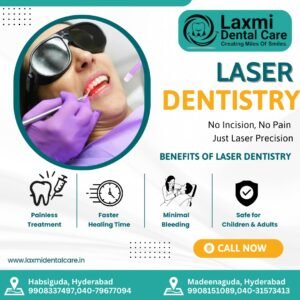 Read more about the article Best laser gum surgery doctors in Habsiguda