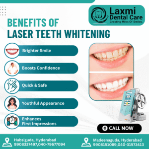 Read more about the article Teeth whitening in Habsiguda
