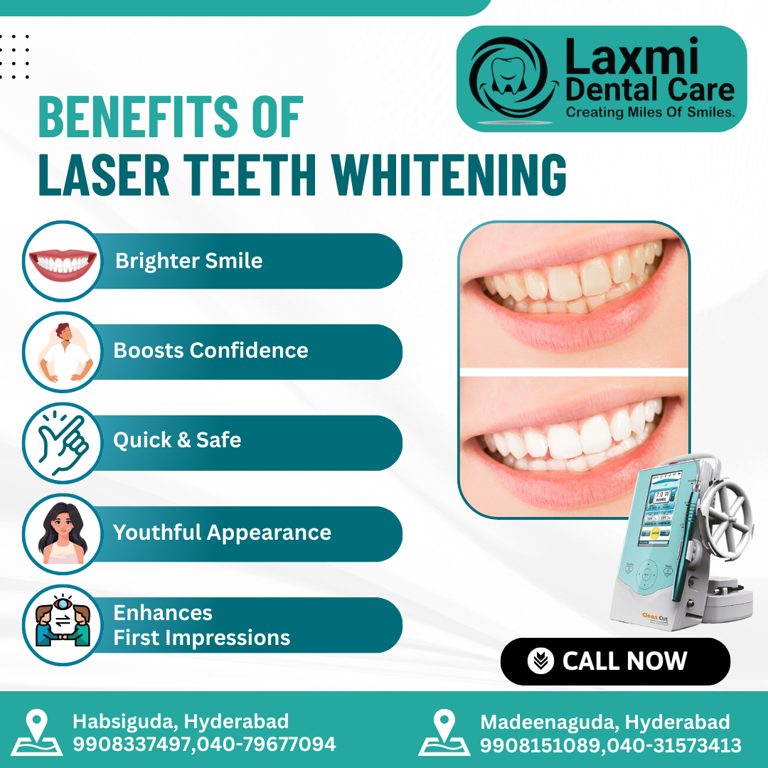 You are currently viewing Teeth whitening in Habsiguda
