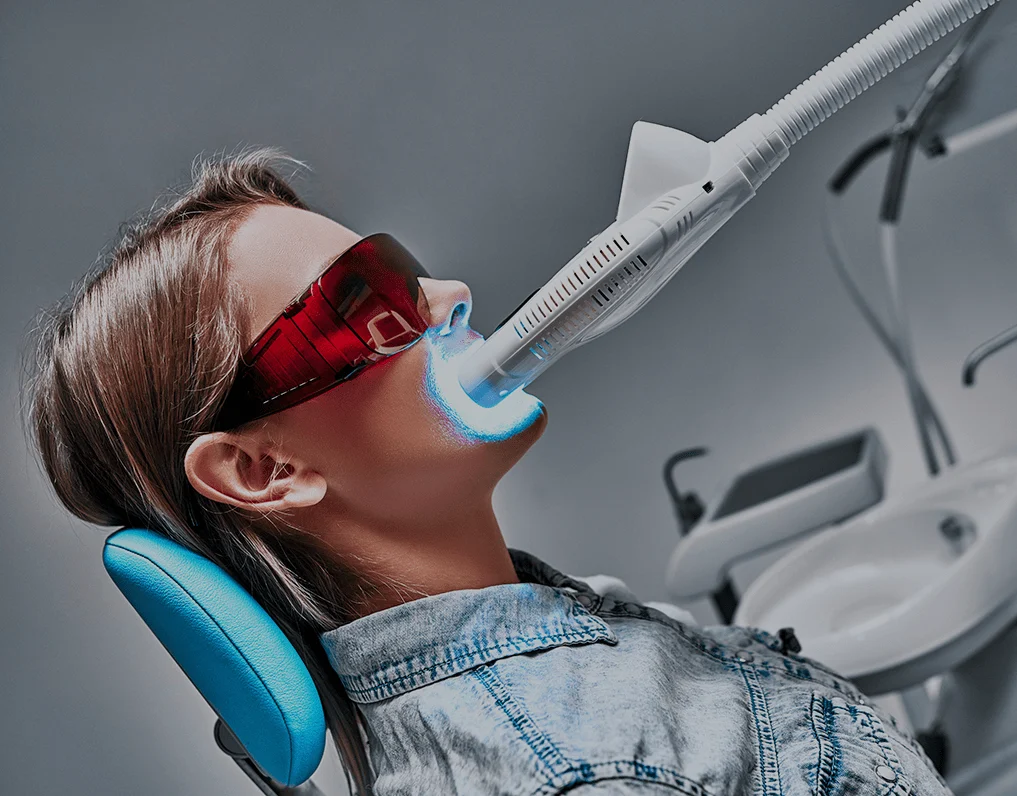 Read more about the article Laser Teeth Whitening Near Me In Habsiguda, Hyderabad